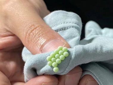 越秀病媒生物防控所臭虫的危害防治措施